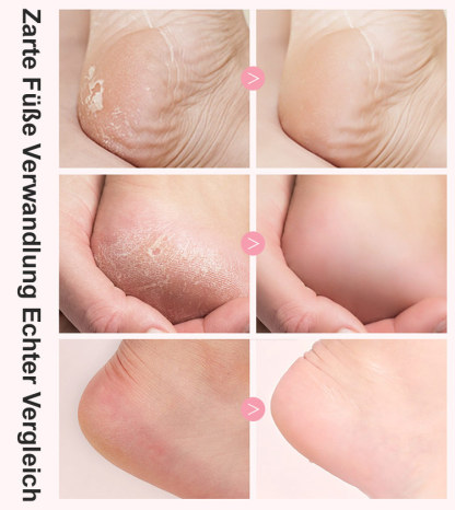 Elektrischer Fußfeilenentferner mit digitaler Anzeige für sofortige Entfernung von abgestorbener Hau