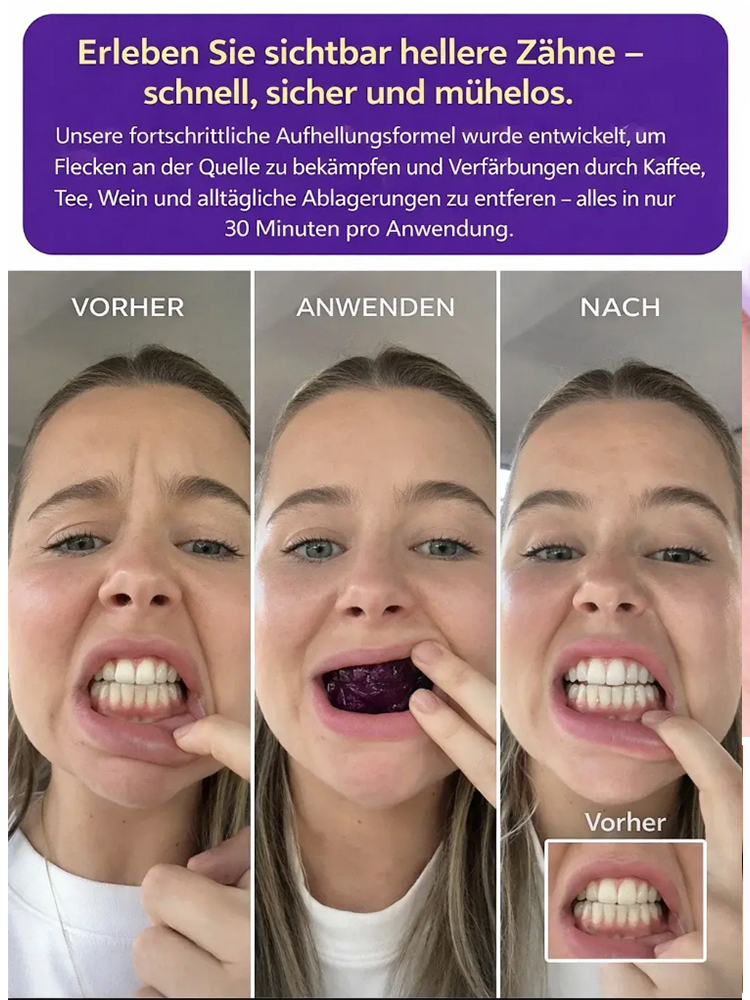 【Zahnaufhellung für zu Hause】Sofortige Aufhellungsstreifen