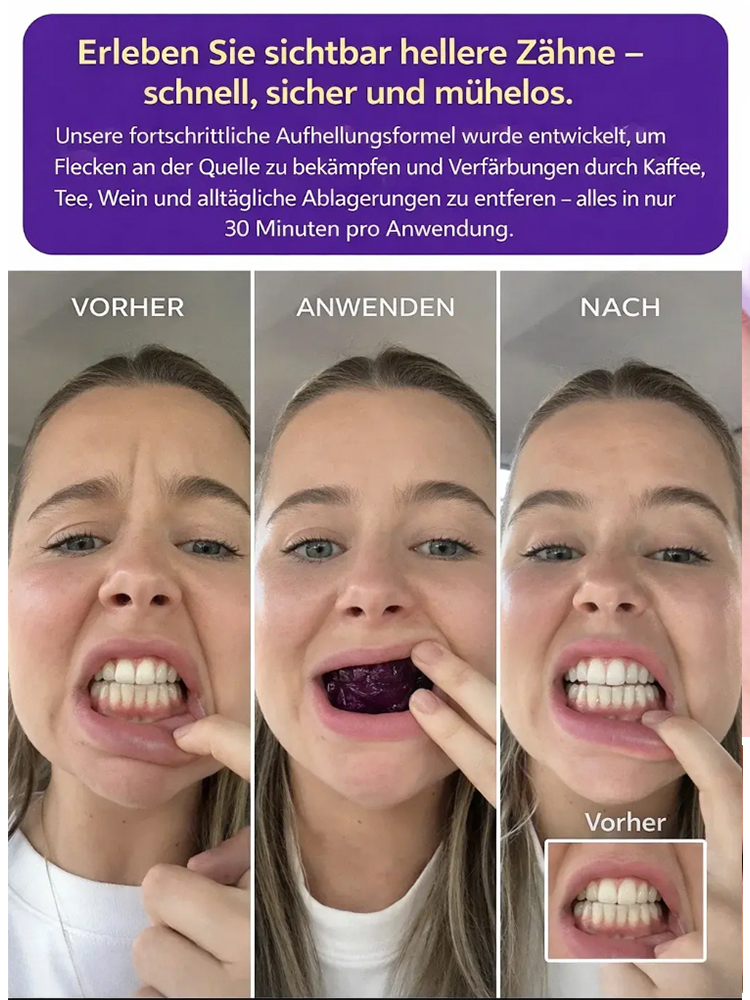 【Zahnaufhellung für zu Hause】Sofortige Aufhellungsstreifen