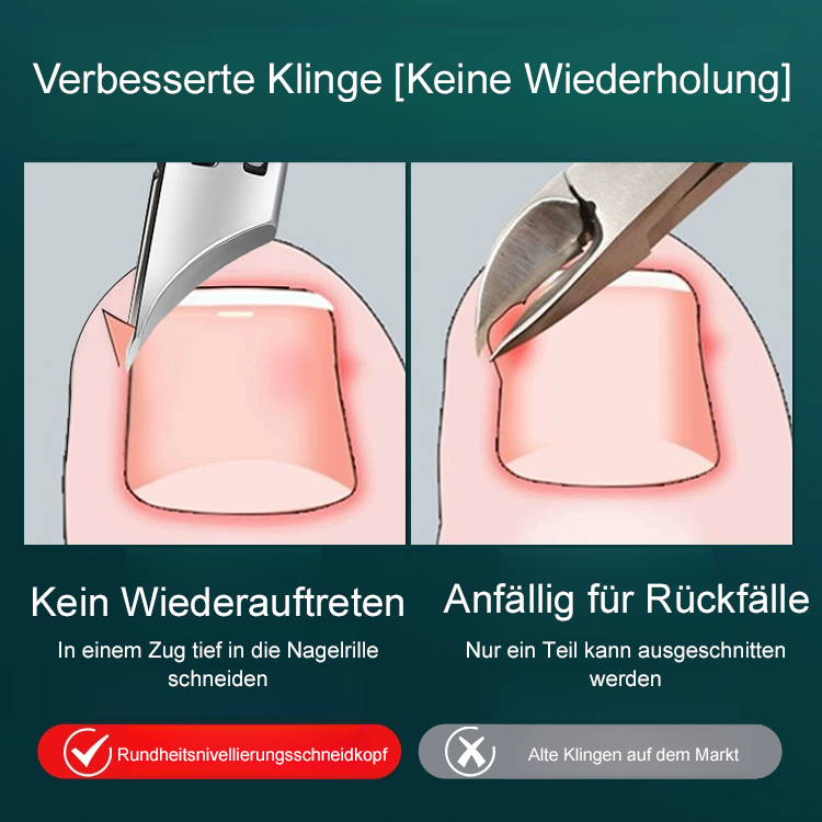 ✂️✂️Endgültige Lösung für wiederkehrende Entzündungen: Bringen Sie professionelle Nagelpflege in Ihre Hausapotheke.
