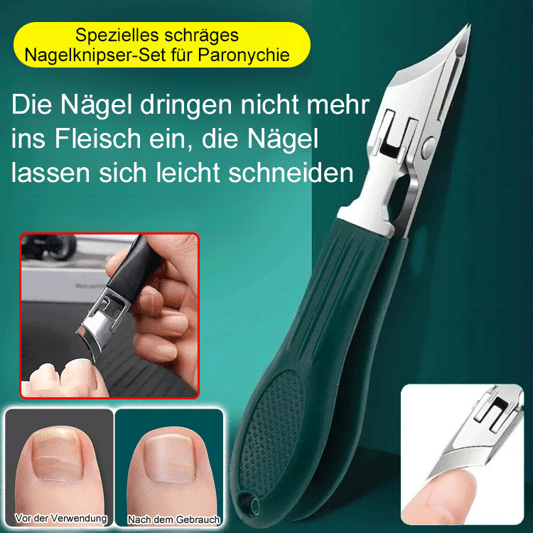 ✂️✂️Endgültige Lösung für wiederkehrende Entzündungen: Bringen Sie professionelle Nagelpflege in Ihre Hausapotheke.