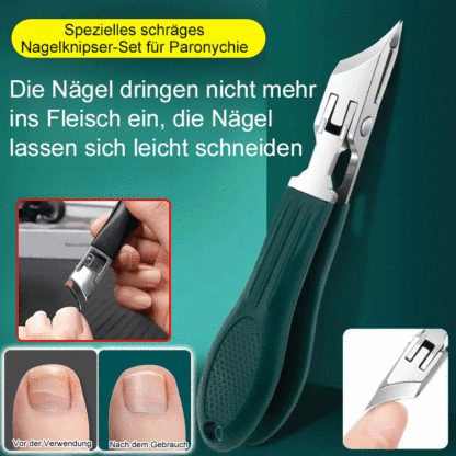 ✂️✂️Endgültige Lösung für wiederkehrende Entzündungen: Bringen Sie professionelle Nagelpflege in Ihre Hausapotheke.