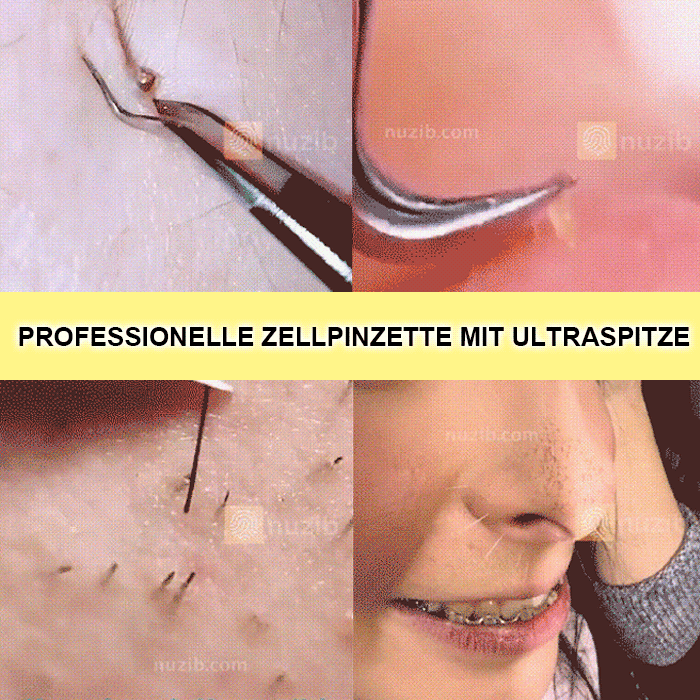 Makelloses Beauty-Design ✨ Hochpräzise, hochharte Zellzange 💎🧖‍♀️ Neugestaltung der reinen Hautstruktur