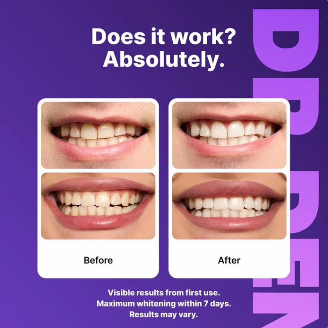 🦷7D Wisdom Tooth Whitening – Gentle, effective dental care with sea salt for bright white teeth 💎
