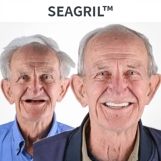😁 Ends Today: 70% OFF! ⏰TEORLAND ™ Medical Full Denture with Strong Suctiond🦷More Confident Smile!