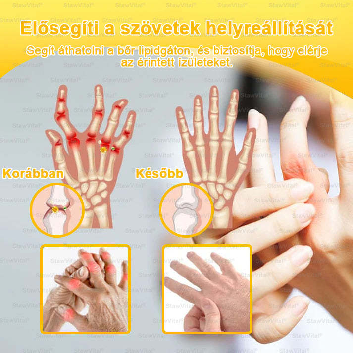 𝑺𝒕𝒂𝒘𝑽𝒊𝒕𝒂𝒍® Botoxot és Méhmérget Tartalmazó Regeneráló Krém Ízületekre és Csontokra | Ortopédiai problémák és ízületi fájdalmak célzott kezelésére🔥