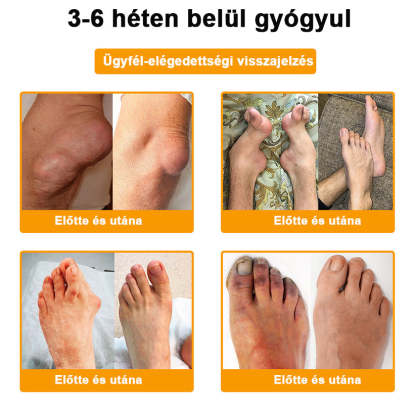 𝑺𝒕𝒂𝒘𝑽𝒊𝒕𝒂𝒍® Botoxot és Méhmérget Tartalmazó Regeneráló Krém Ízületekre és Csontokra | Ortopédiai problémák és ízületi fájdalmak célzott kezelésére🔥