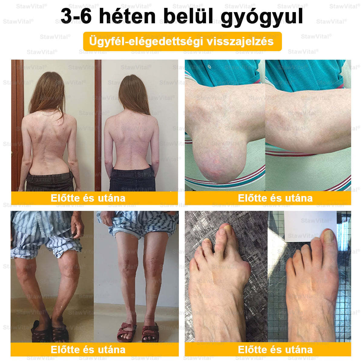 𝑺𝒕𝒂𝒘𝑽𝒊𝒕𝒂𝒍® Botoxot és Méhmérget Tartalmazó Regeneráló Krém Ízületekre és Csontokra | Ortopédiai problémák és ízületi fájdalmak célzott kezelésére🔥