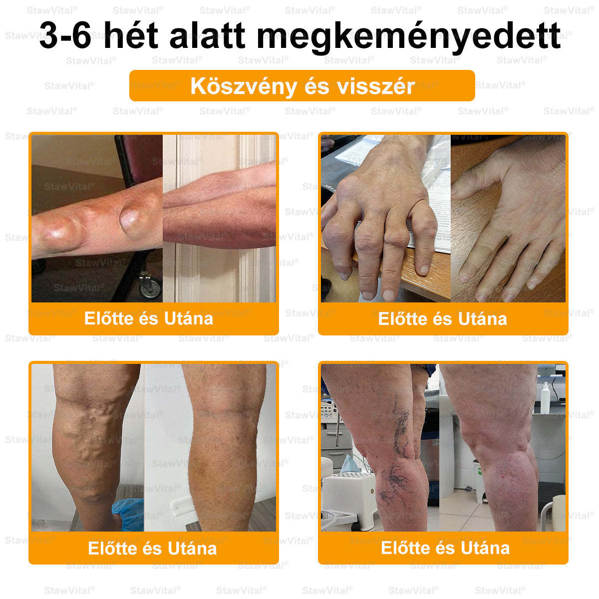 𝑺𝒕𝒂𝒘𝑽𝒊𝒕𝒂𝒍® Botoxot és Méhmérget Tartalmazó Regeneráló Krém Ízületekre és Csontokra | Ortopédiai problémák és ízületi fájdalmak célzott kezelésére🔥