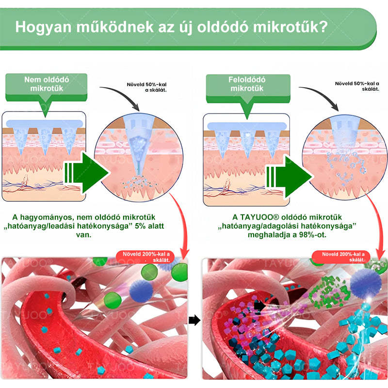 ✨✨🇭🇺 Hivatalos bolt | 💫 TAYUOO® Moringa · Berberin × NAD+ 10 az 1-ben Fejlett Nano Mikrotűs Tapasz (naponta csak egyszer, látható változás 7 nap alatt) ✅ elhízás, megereszkedett bőr, cukorbetegség, alvási apnoe, ízületi panaszok és még sok más esetén