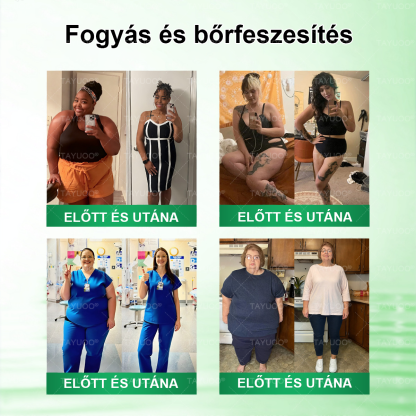 ✨✨🇭🇺 Hivatalos bolt | 💫 TAYUOO® Moringa · Berberin × NAD+ 10 az 1-ben Fejlett Nano Mikrotűs Tapasz (naponta csak egyszer, látható változás 7 nap alatt) ✅ elhízás, megereszkedett bőr, cukorbetegség, alvási apnoe, ízületi panaszok és még sok más esetén