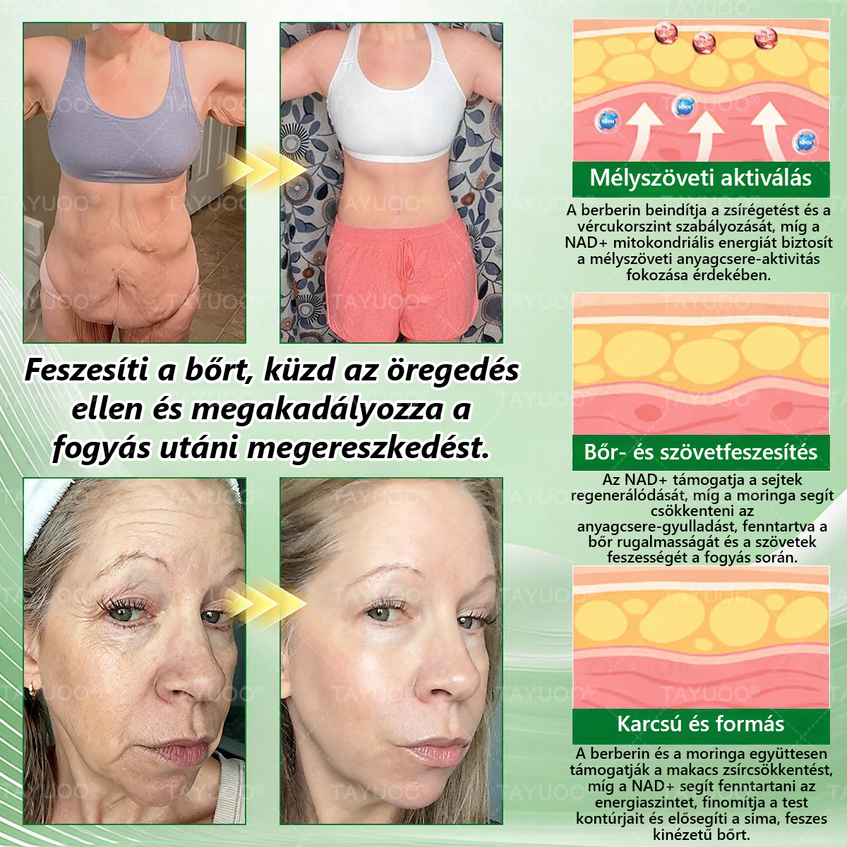✨✨🇭🇺 Hivatalos bolt | 💫 TAYUOO® Moringa · Berberin × NAD+ 10 az 1-ben Fejlett Nano Mikrotűs Tapasz (naponta csak egyszer, látható változás 7 nap alatt) ✅ elhízás, megereszkedett bőr, cukorbetegség, alvási apnoe, ízületi panaszok és még sok más esetén