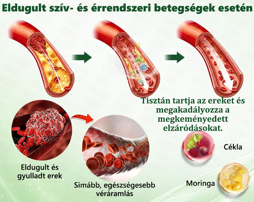 ✨✨🇭🇺 Hivatalos bolt | 💫 TAYUOO® Moringa · Berberin × NAD+ 10 az 1-ben Fejlett Nano Mikrotűs Tapasz (naponta csak egyszer, látható változás 7 nap alatt) ✅ elhízás, megereszkedett bőr, cukorbetegség, alvási apnoe, ízületi panaszok és még sok más esetén