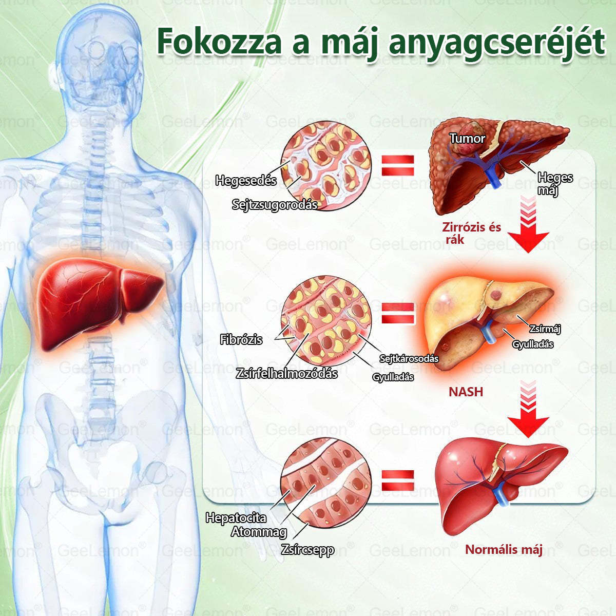 ✨Moringa · Berberine × NAD+ 10-in-1 Advanced Nano GeeLemon® Glumasetide 8az 1-ben Karcsú és EgészségesNano Mikrotűs Tapasz (Napi 1alkalom – látható változásakár 7 nap alatt) ✅ Elhízásra,bőrfeszesítésre,cukorbetegségre, alvásiapnoéra, ízületekre stb HU