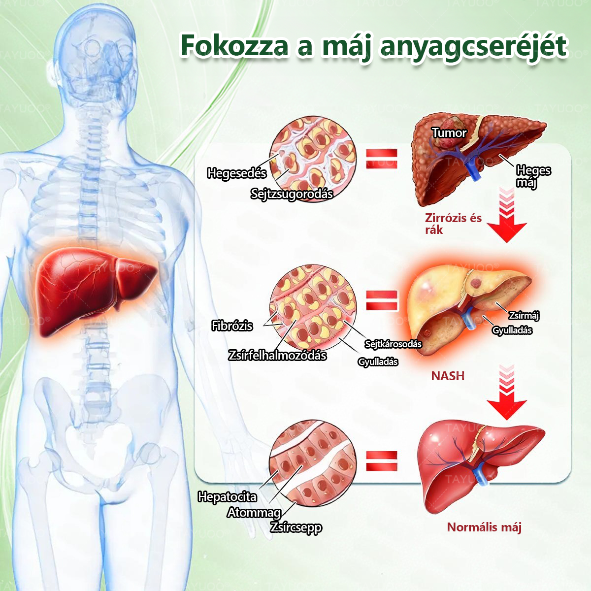 ✨✨🇭🇺 Hivatalos bolt | 💫 TAYUOO® Moringa · Berberin × NAD+ 10 az 1-ben Fejlett Nano Mikrotűs Tapasz (naponta csak egyszer, látható változás 7 nap alatt) ✅ elhízás, megereszkedett bőr, cukorbetegség, alvási apnoe, ízületi panaszok és még sok más esetén