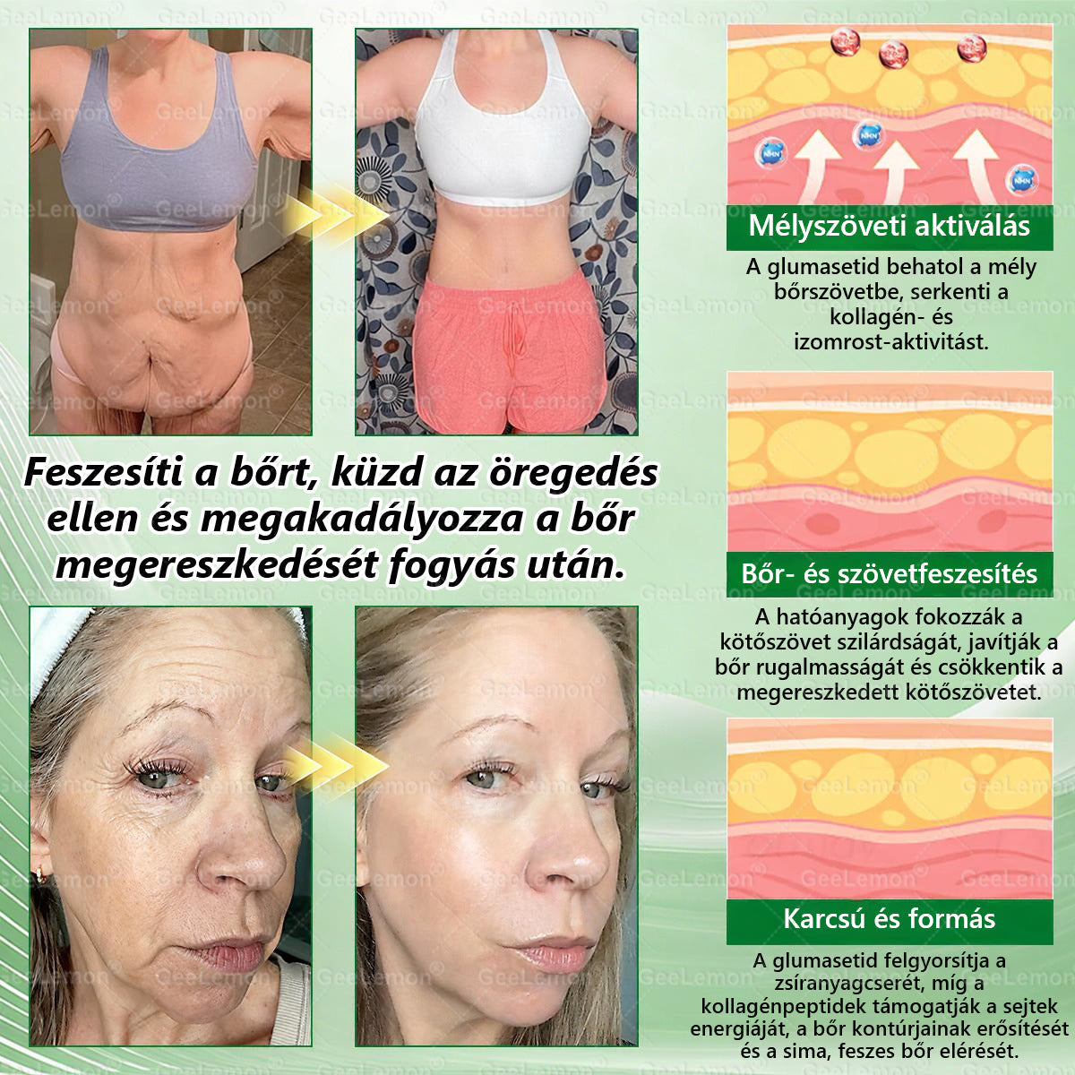 ✨Moringa · Berberine × NAD+ 10-in-1 Advanced Nano GeeLemon® Glumasetide 8az 1-ben Karcsú és EgészségesNano Mikrotűs Tapasz (Napi 1alkalom – látható változásakár 7 nap alatt) ✅ Elhízásra,bőrfeszesítésre,cukorbetegségre, alvásiapnoéra, ízületekre stb HU