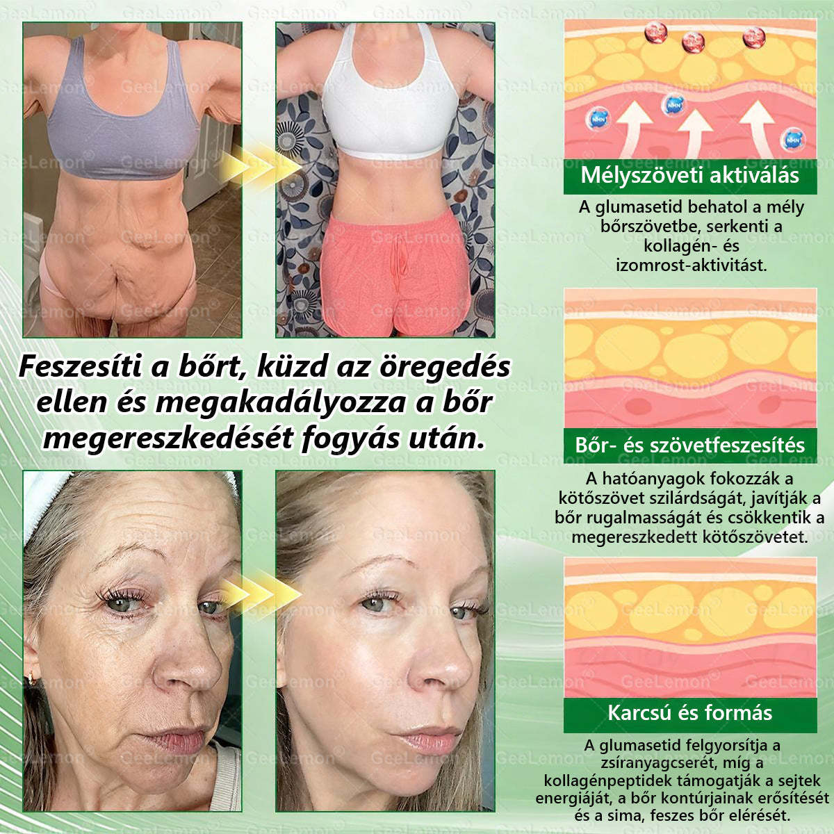 ✨Moringa · Berberine × NAD+ 10-in-1 Advanced Nano GeeLemon® Glumasetide 8az 1-ben Karcsú és EgészségesNano Mikrotűs Tapasz (Napi 1alkalom – látható változásakár 7 nap alatt) ✅ Elhízásra,bőrfeszesítésre,cukorbetegségre, alvásiapnoéra, ízületekre stb HU