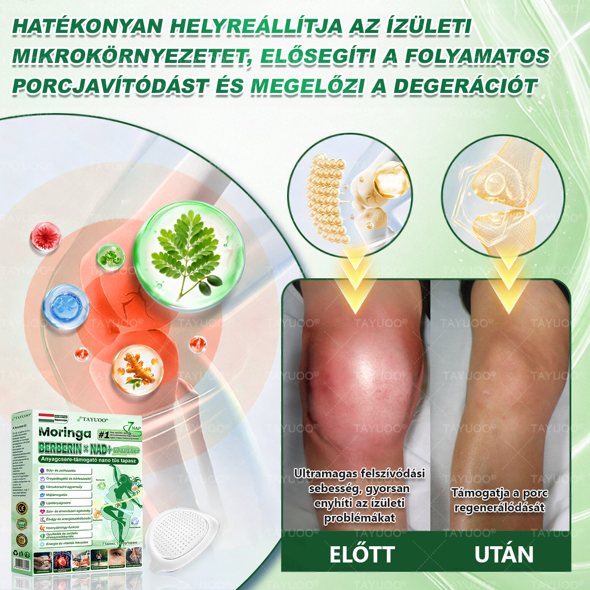 ✨✨🇭🇺 Hivatalos bolt | 💫 TAYUOO® Moringa · Berberin × NAD+ 10 az 1-ben Fejlett Nano Mikrotűs Tapasz (naponta csak egyszer, látható változás 7 nap alatt) ✅ elhízás, megereszkedett bőr, cukorbetegség, alvási apnoe, ízületi panaszok és még sok más esetén