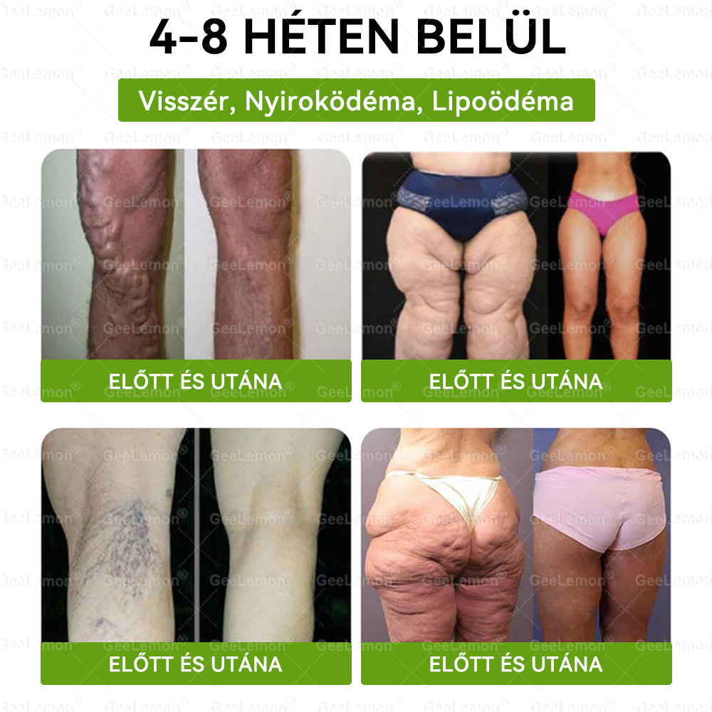 ✨Moringa · Berberine × NAD+ 10-in-1 Advanced Nano GeeLemon® Glumasetide 8az 1-ben Karcsú és EgészségesNano Mikrotűs Tapasz (Napi 1alkalom – látható változásakár 7 nap alatt) ✅ Elhízásra,bőrfeszesítésre,cukorbetegségre, alvásiapnoéra, ízületekre stb HU