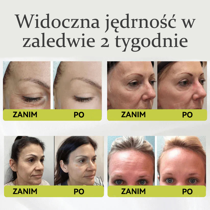 ✨👨‍⚕️Wyprodukowano w UE, wysyłane bezpośrednio z kraju pochodzenia 💫Tiworld® Botox & Retinol Serum Cream — lifting i ujędrnianie, redukcja zmarszczek — ostatni dzień promocji, 30% zniżki na wszystko!