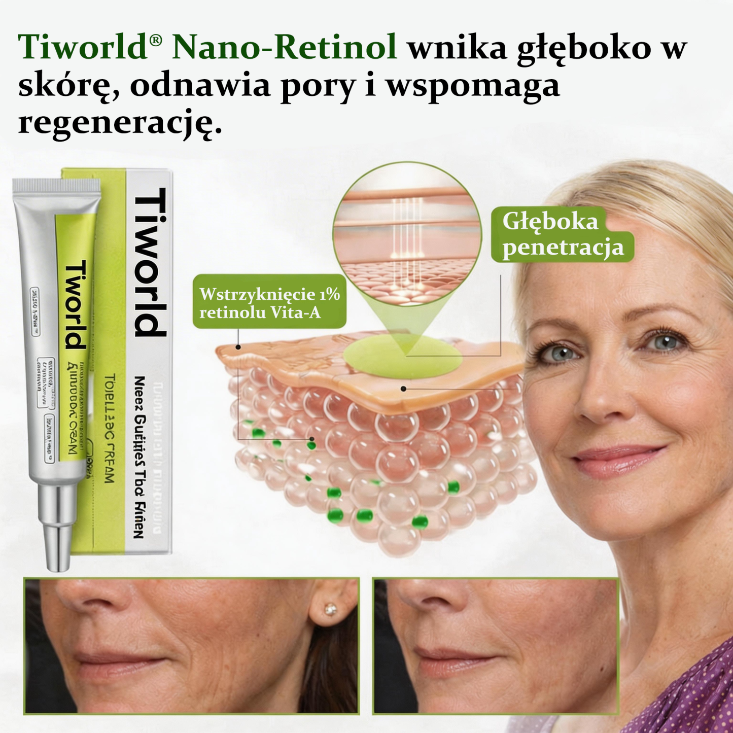 ✨👨‍⚕️Wyprodukowano w UE, wysyłane bezpośrednio z kraju pochodzenia 💫Tiworld® Botox & Retinol Serum Cream — lifting i ujędrnianie, redukcja zmarszczek — ostatni dzień promocji, 30% zniżki na wszystko!