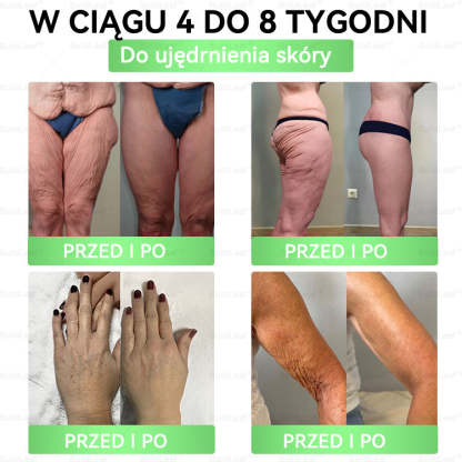 [Copy]🍃Oficjalny sklep Polska | BuildLeaf® GLP-1 8-w-1 Fit & Vital Rozwiązanie (Jednorazowe dziennie, widoczne zmiany w ciągu 7 dni) ✅ Otyłość, zdrowie sercowo-naczyniowe, cukrzyca, bezdech senny, zdrowie jelit, problemy ze stawami i inne.