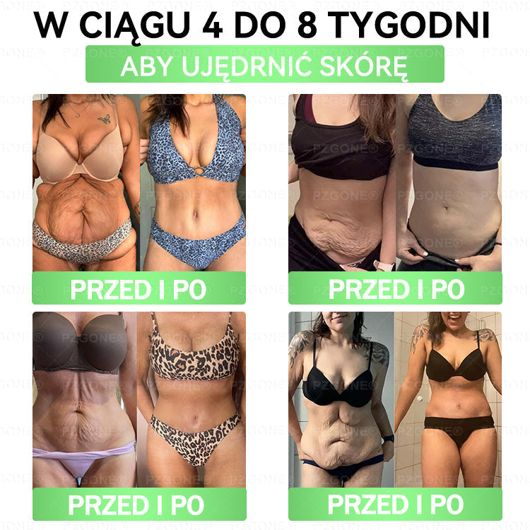 🌱 💞Oficjalny Sklep | 👩‍⚕️🎁 𝐏𝐙𝐆𝐎𝐍𝐄® Superfood 𝑵𝒂𝒏𝒐 Mikronakłuwana Plaster 🇵🇱(Tylko raz dziennie, widoczne zmiany już w 7 dni)✅ Na otyłość, 🅛🅞🅞🅢🅔 🅢🅚🅘🅝 wiotką skórę, cukrzycę, bezdech senny, problemy ze stawami i wiele więcej