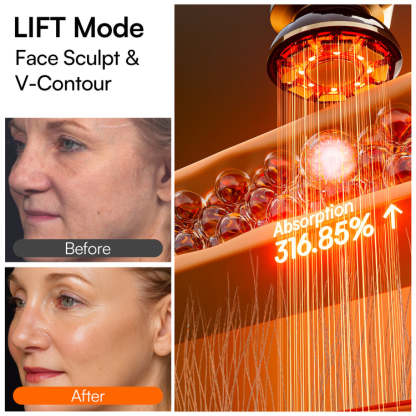SKINVEXA Microcurrent Facial Device
