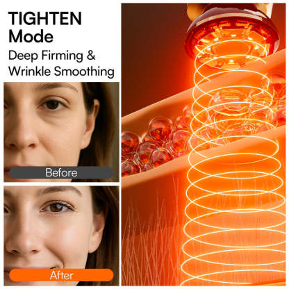 SKINVEXA Microcurrent Facial Device