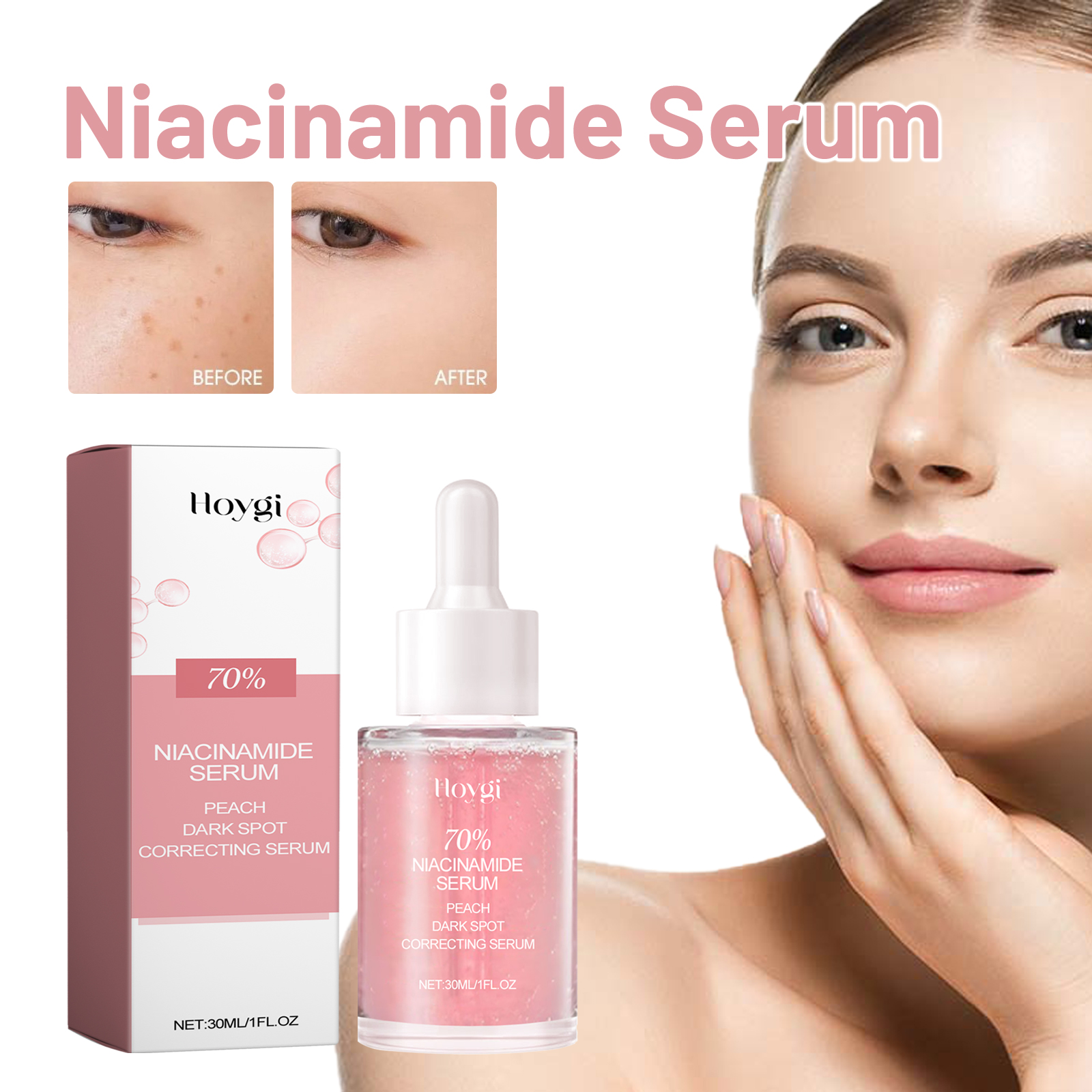 Hoygi Niacinamide Serum Brightening