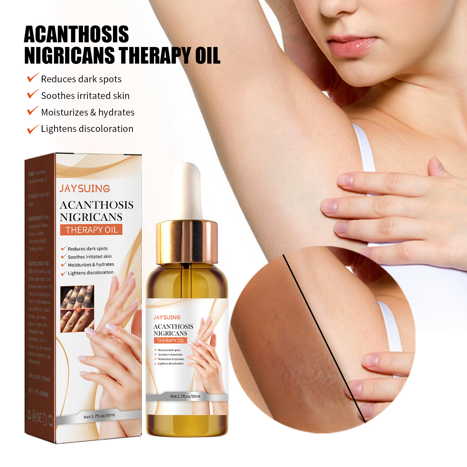 Acanthosis Nigricans Repair Oil Brightening Body Care