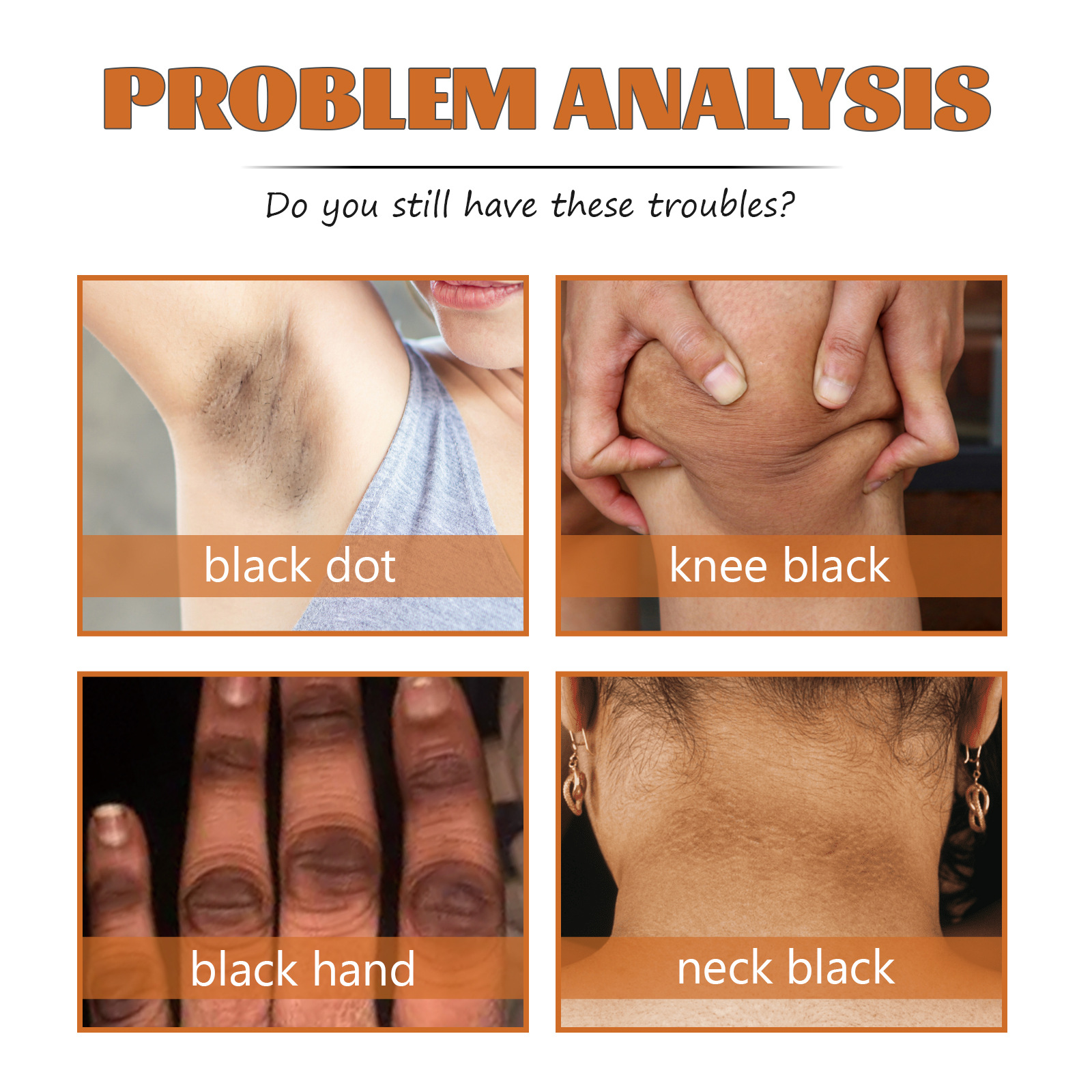 Acanthosis Nigricans Repair Oil Brightening Body Care