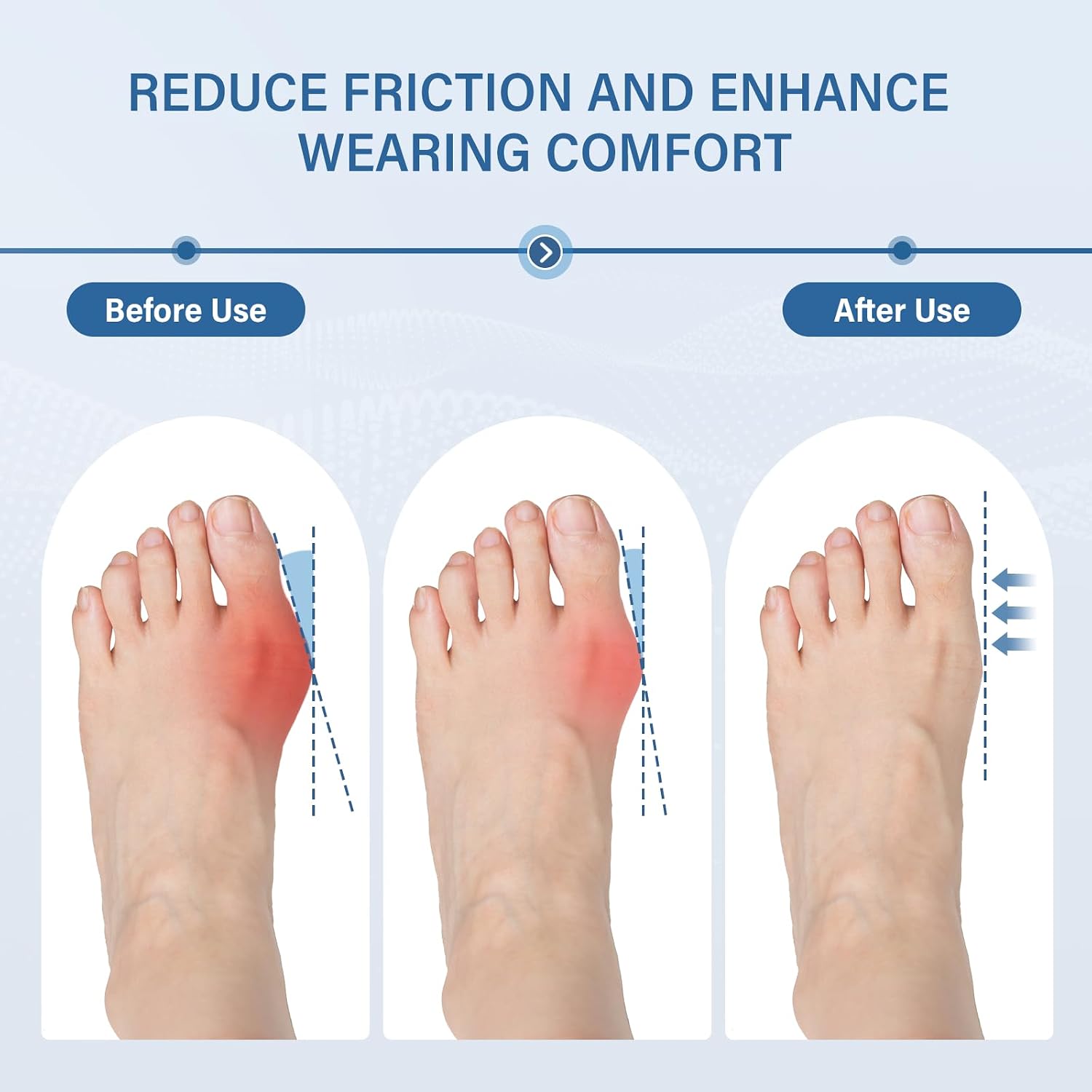 Bunion Corrector 2-Pack for Women & Men, Ultra-Thin Toe Splint