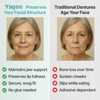 🌎Ends Today: 70% OFF! ⏰Yagoo™ Medical Full Denture with Strong Suctiond🦷Obtain American Dental Association (ADA) Certification