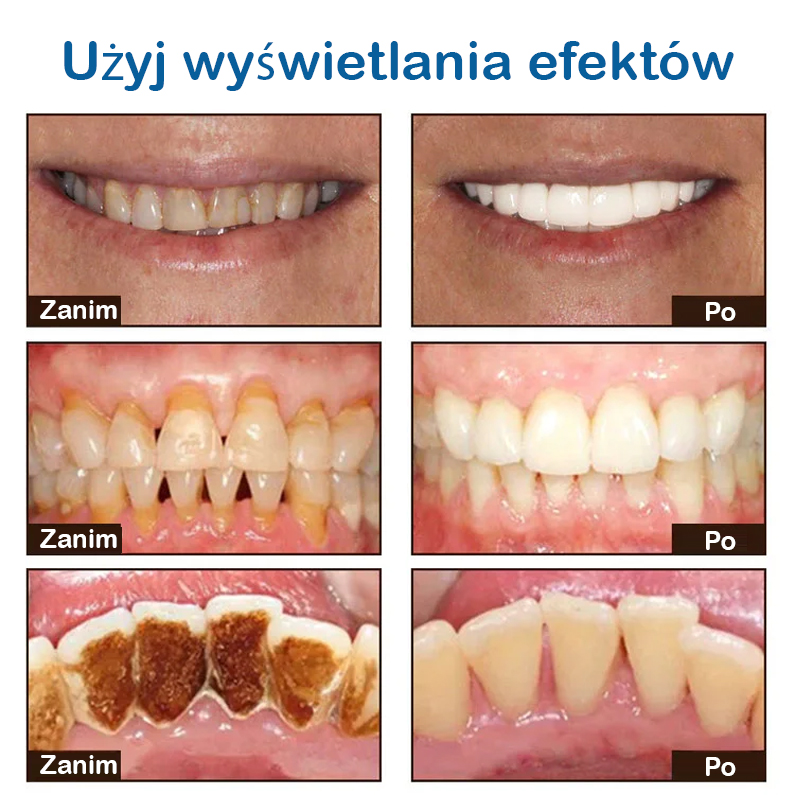 🚀 Wybielająca Pasta z Niacynamidem: 14 dni do jasnego uśmiechu, No more żółtych osadów!