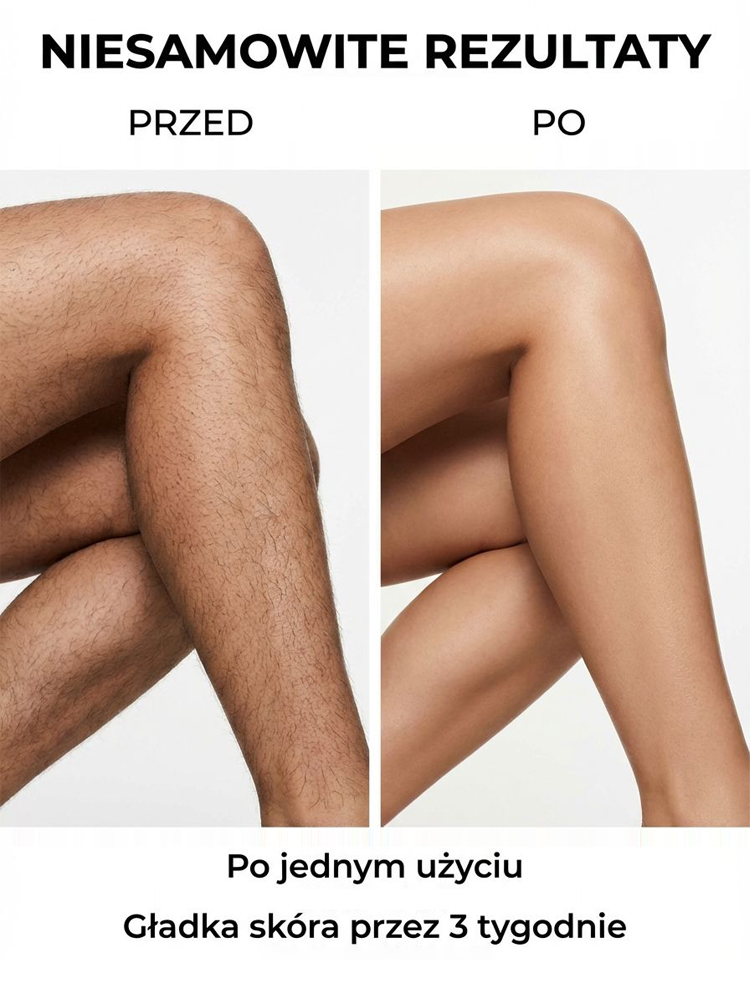 [Bezbolesna depilacja] Krem do depilacji z ekstraktami roślinnymi i olejem kokosowym 【Depilacja klasy medycznej — 100% bezpieczeństwa!】