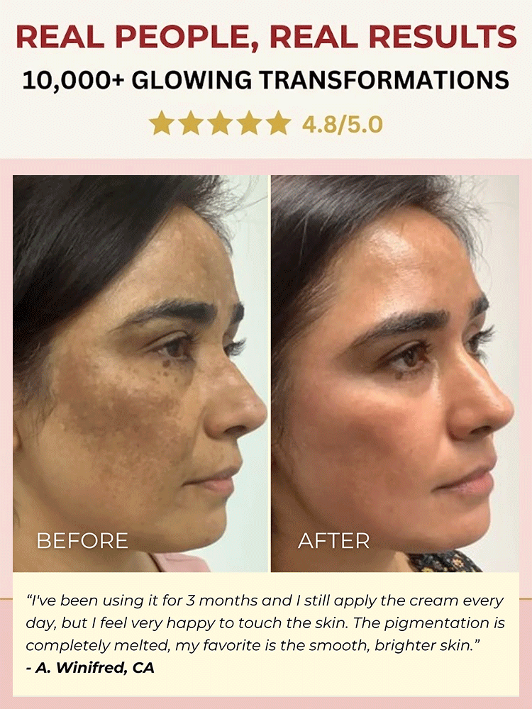 【3 in 1】Whitening, Anti-Blemish and Anti-Wrinkle Essence【See visible results in just 5 days!】【💯We Promise: If Ineffective, We Offer a 10x Refund!💯】