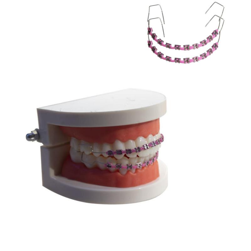 Set of 2 pcs Colorful Temporary Dental Decorations, Metal Orthodontic Kit (includes wires, brackets, ligatures), Lightweight and Durable Temporary Dental Decoration Toys