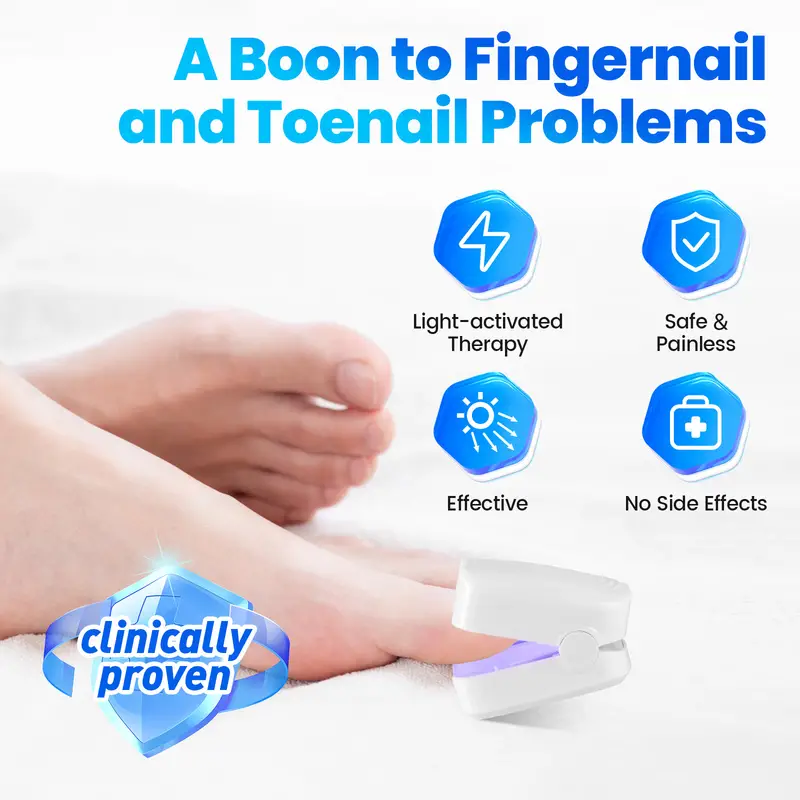 Urządzenie laserowe do czyszczenia grzyba paznokci, laser przeciwgrzybiczy Laserowe leczenie grzybicy paznokci na uszkodzone, przebarwione grube paznokcie u rąk i nóg, terapia paznokci na grzybicę paznokci, wygodna do użytku domowego