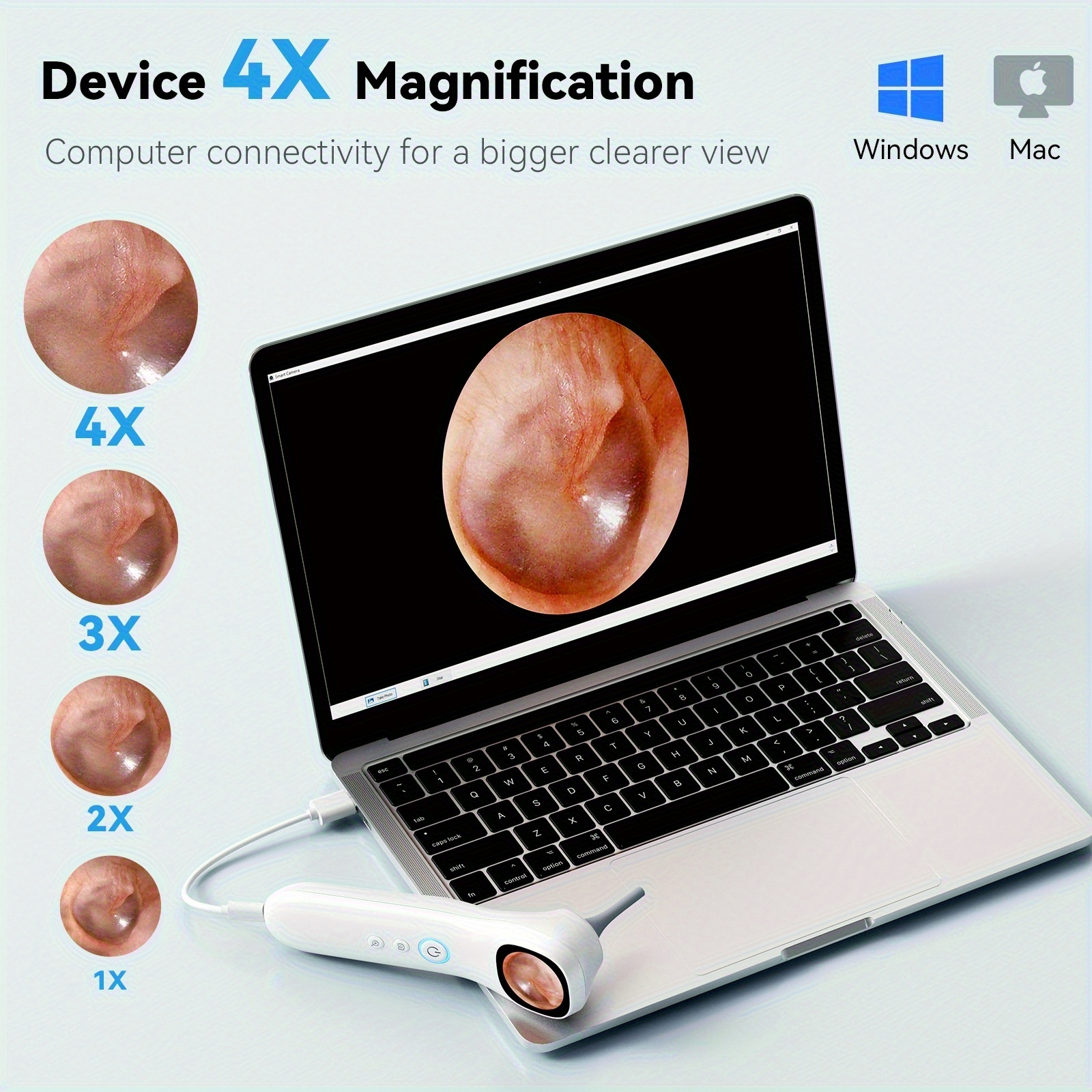 5-In-1 Intelligent Ear Canal Inspection Device with Display And In-Ear Camera - 3 Types of Attachments (Ear, Nose, Throat/Skin), USB Rechargeable, Suitable for Adults And Pets, Comes with 18 Replaceable Protective Covers