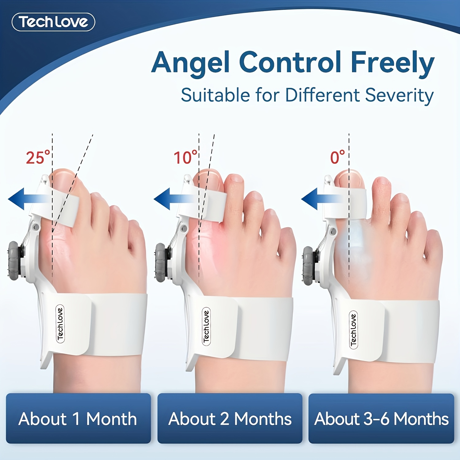 Correction Kit, Adjustable Button Splints, Toe Separator, And Toe Training Band