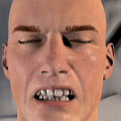 🦷Adjustable  Anti-Snoring Mouthpiece