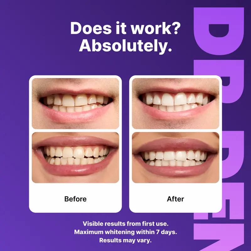 Drdent Purple Teeth Whitening Strips - 7/21 Whitening Sessions - Safe For Enamel - Non Sensitive Teeth Whitening - Peroxide-free