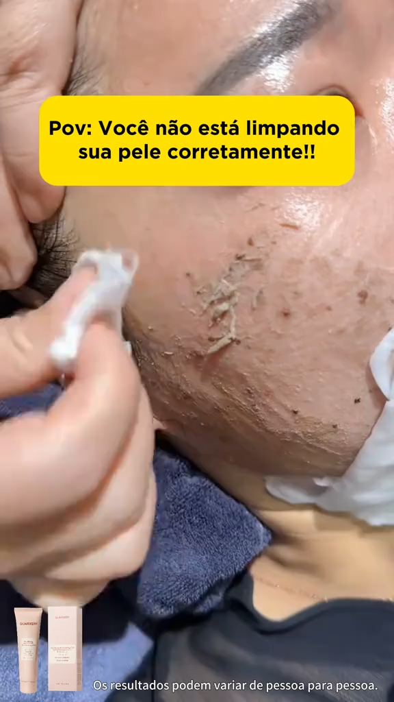 QUARXERY Esfoliante Facial, Esfoliante Corporal, Gel de Limpeza Facial - Gel Exfoliante Purificante