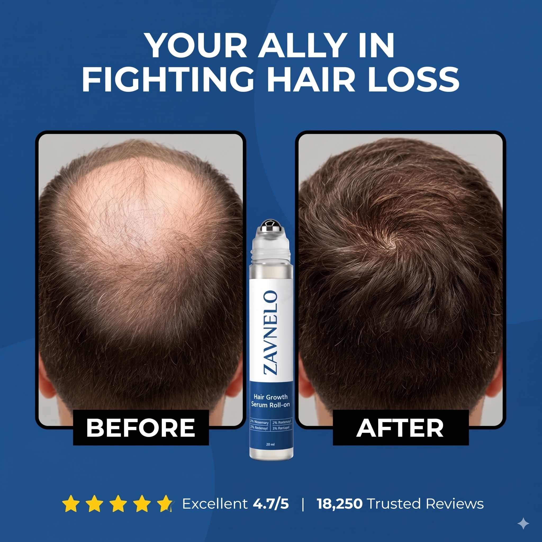 Zavnelo® Hair Growth Roll-On Serum — Combat Thinning & Promote Thicker, Fuller Hair