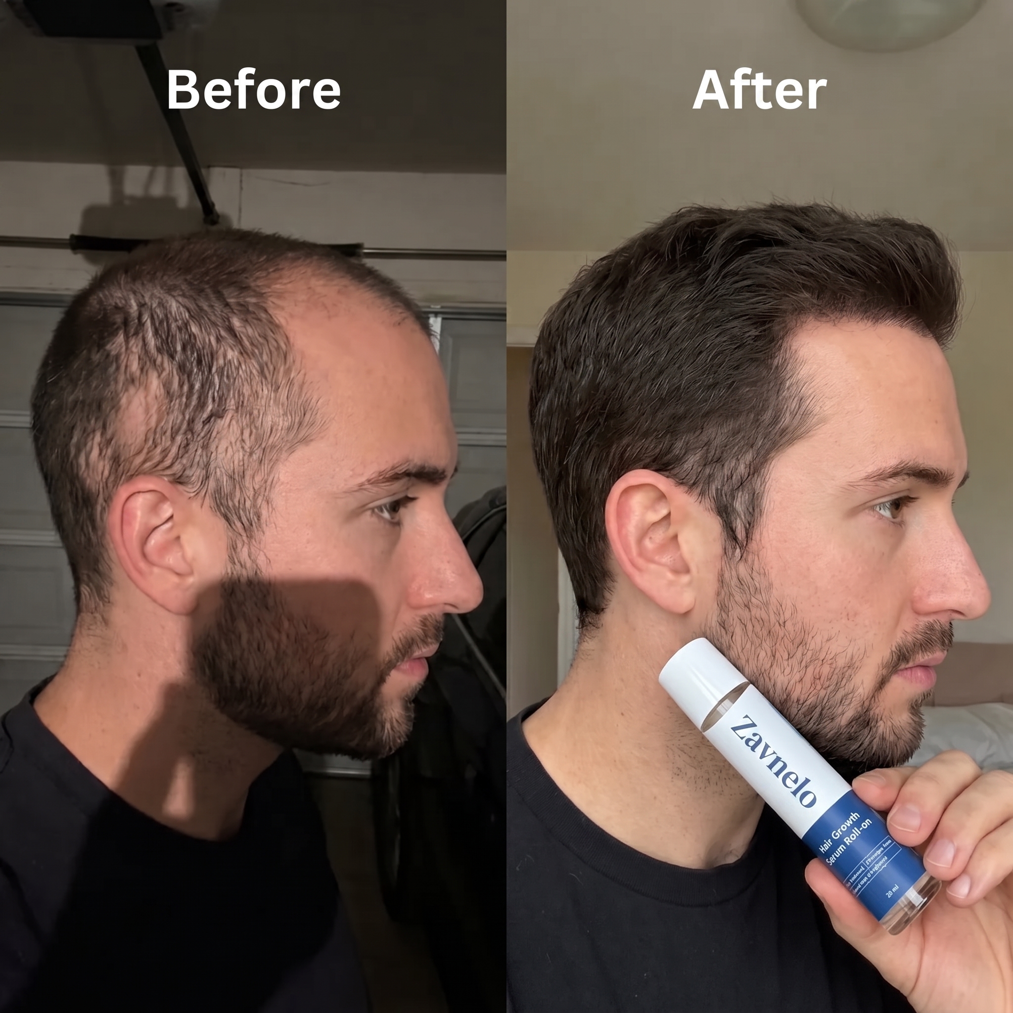 Hair result 1