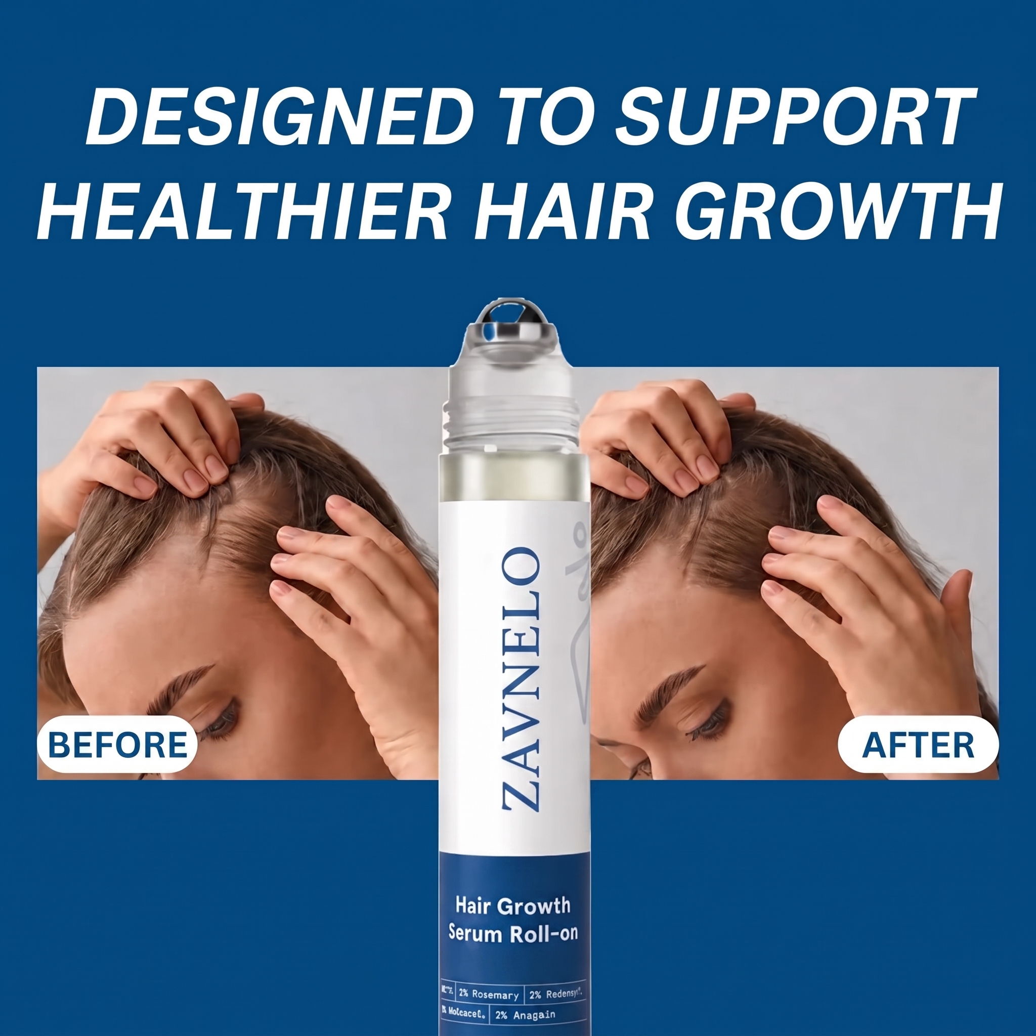 Zavnelo® Hair Growth Roll-On Serum — Combat Thinning & Promote Thicker, Fuller Hair
