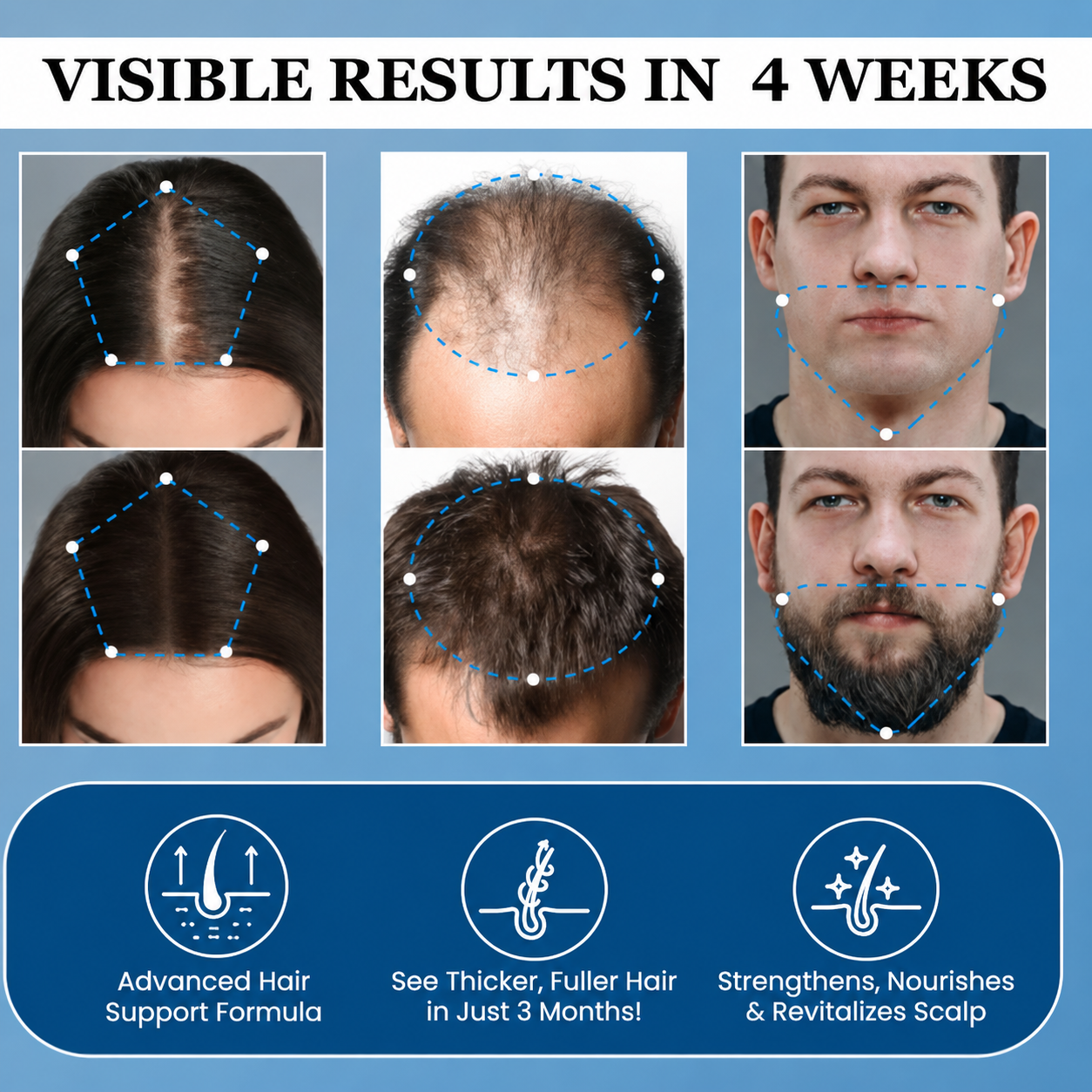 Zavnelo® Hair Growth Roll-On Serum — Combat Thinning & Promote Thicker, Fuller Hair
