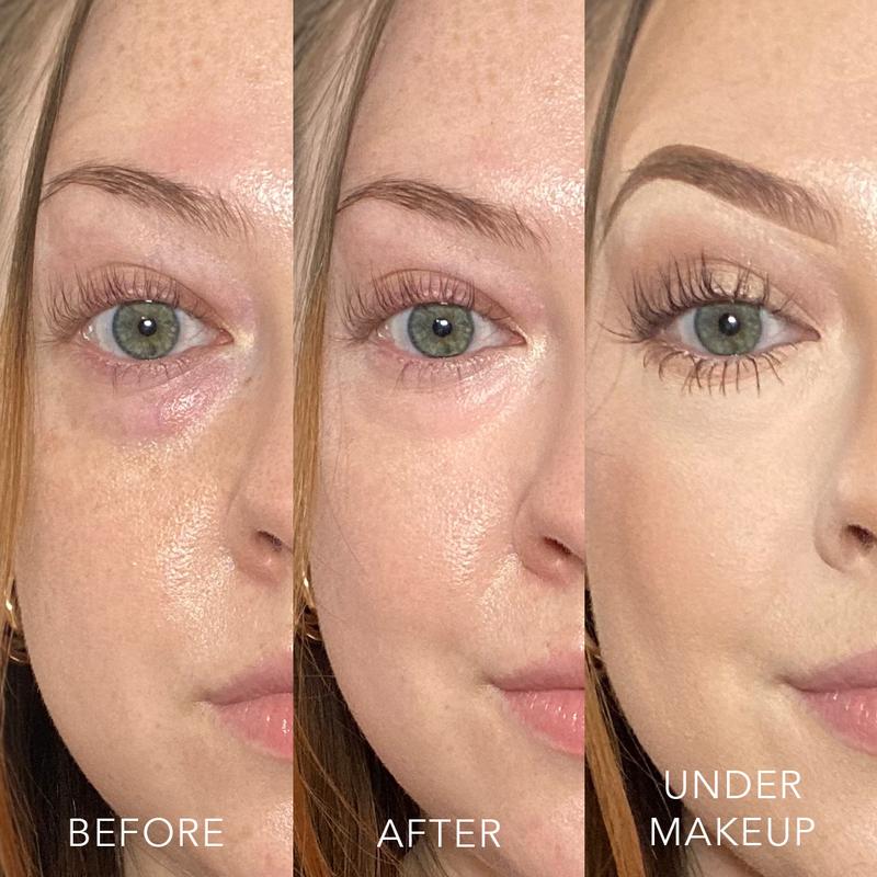 Luminous Undereye Corrector Concealer | Buildable Radiant Color Correcting Coverage