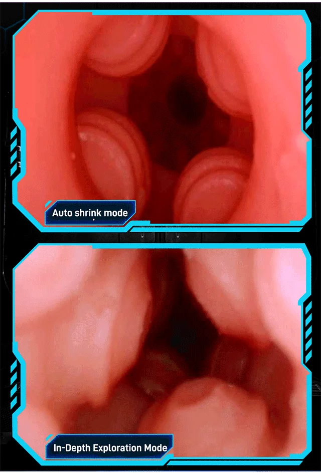 [Confidential delivery]ROSOPL Effortlessly Elevate Your Joy: Dive into Pleasure with Our Fully Automatic Decompression Cup!